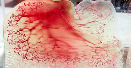 Beültethető tüdő 3D nyomtatással